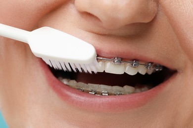 Photo of Smiling woman with dental braces cleaning teeth, closeup