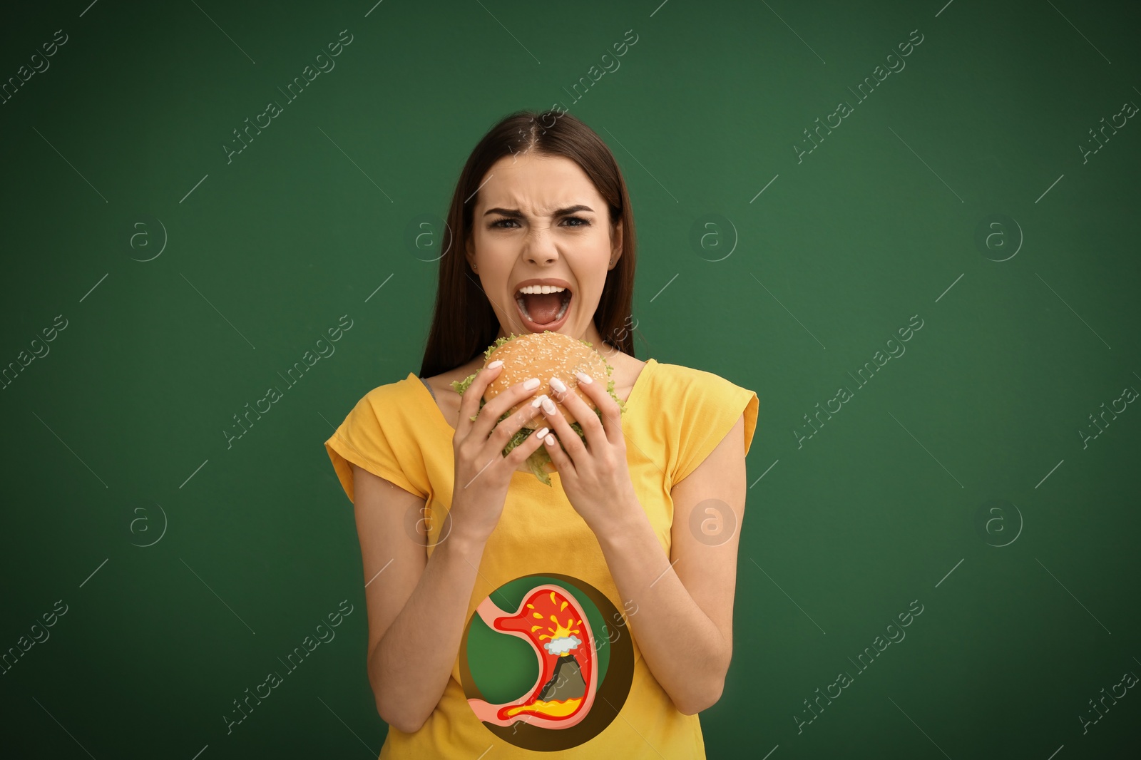 Image of Improper nutrition can lead to heartburn or other gastrointestinal problems. Woman eating burger on green background. Illustration of stomach with erupting volcano as acid indigestion