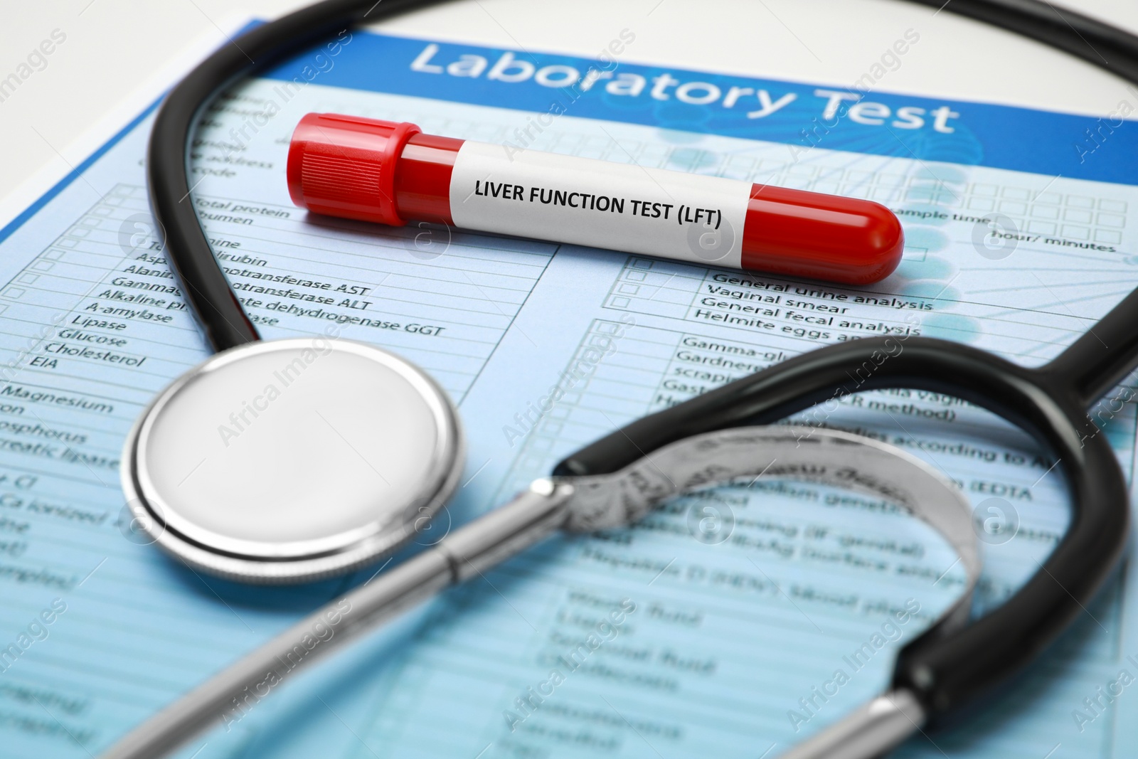 Photo of Liver Function Test. Tube with blood sample, form and stethoscope on table, closeup