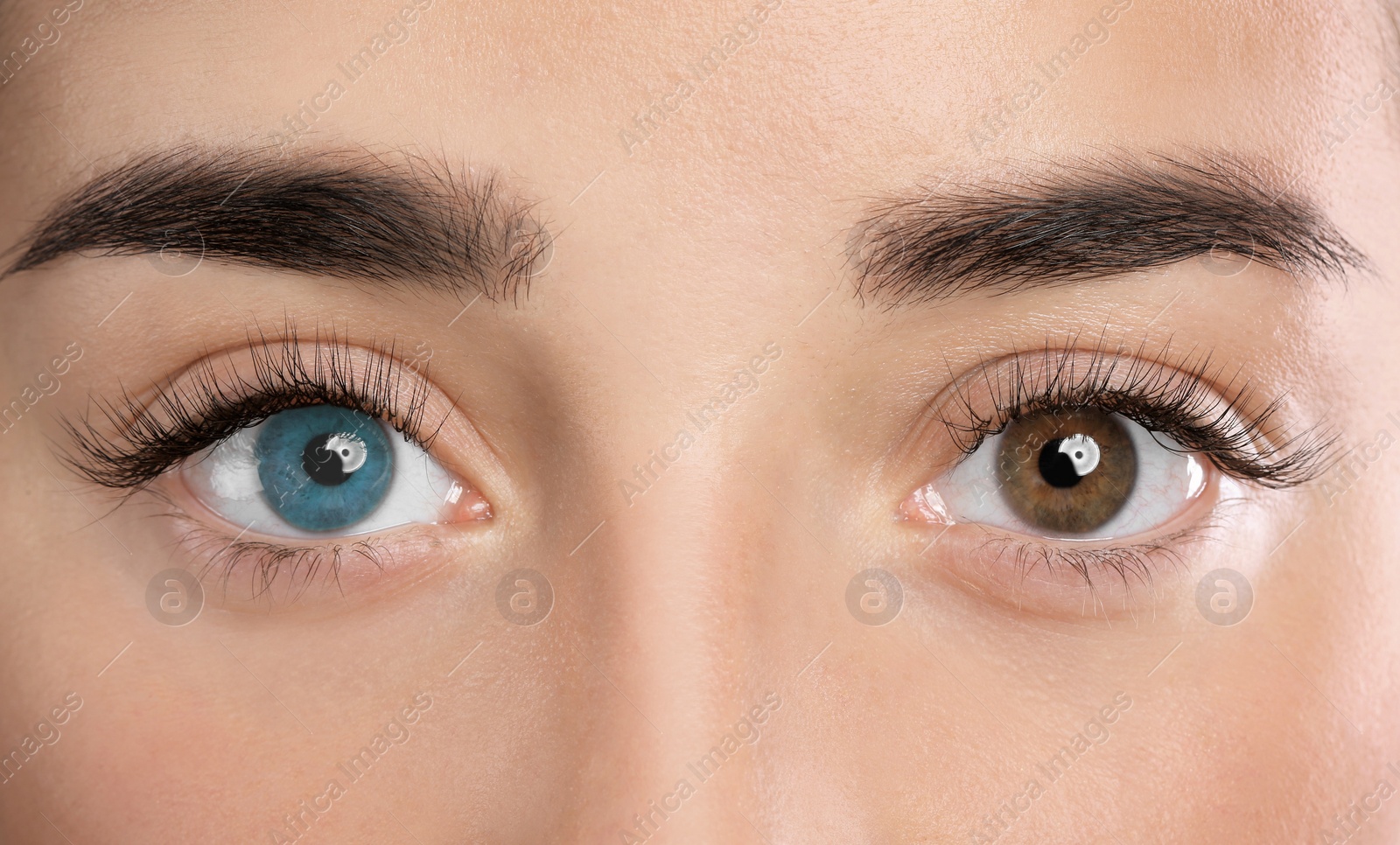 Image of Woman with different colors of eyes, closeup. Heterochromia iridis