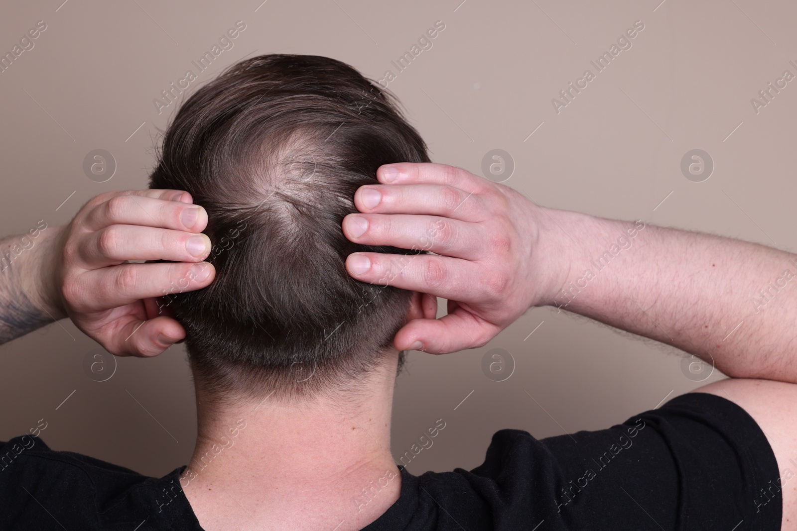 Photo of Baldness concept. Man with bald spot on beige background, back view