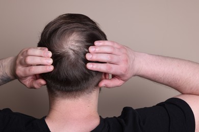 Baldness concept. Man with bald spot on beige background, back view