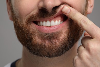 Man showing his healthy teeth and gums on grey background, closeup