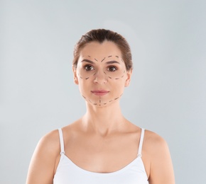 Portrait of woman with marks on face against grey background. Cosmetic surgery