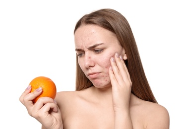 Young woman with acne problem holding orange on white background. Skin allergy