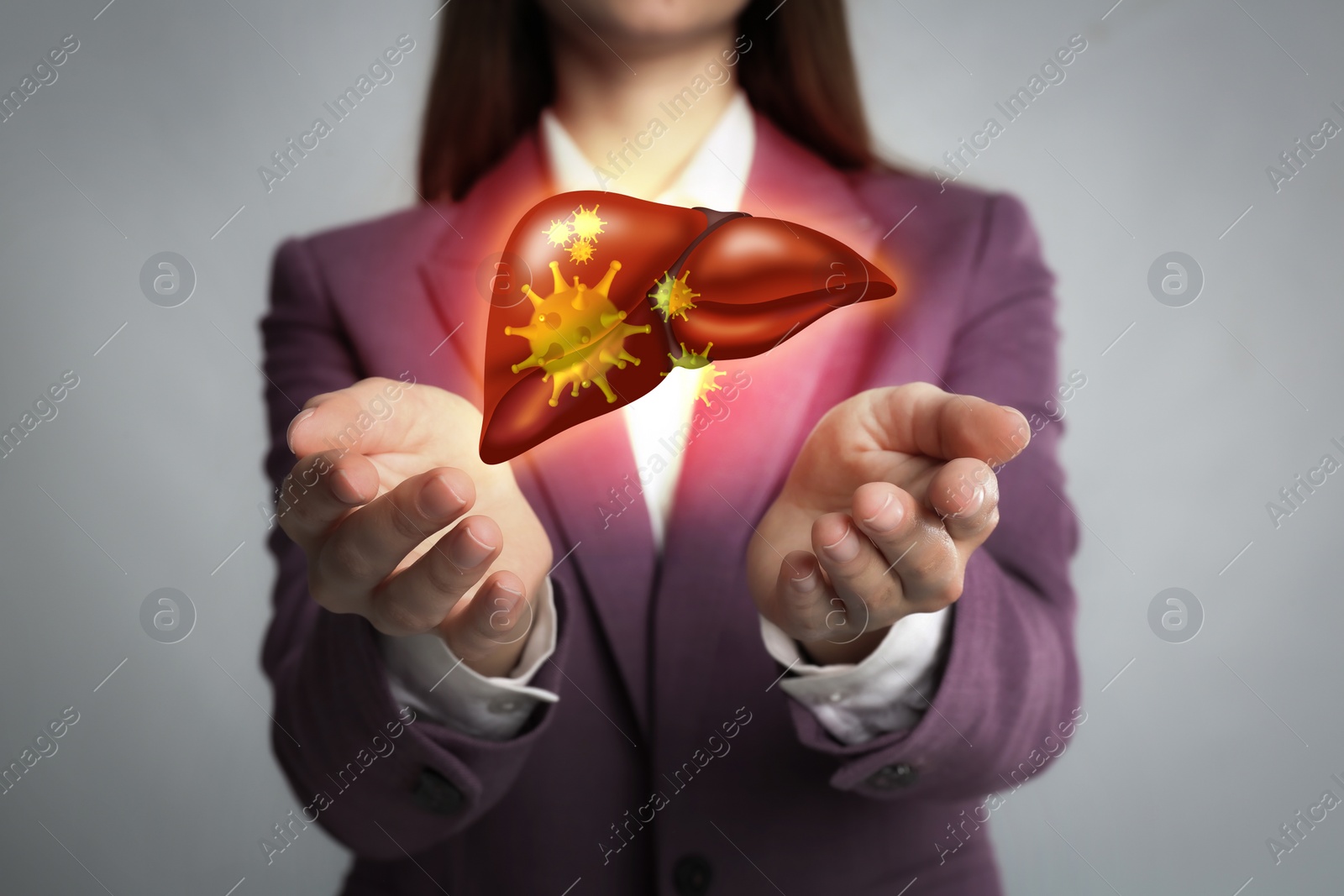 Image of Woman and illustration of unhealthy liver on light grey background. Viral hepatitis