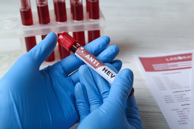 Photo of Scientist holding tube with blood sample and label Anti HEV at white wooden table, closeup