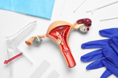 Photo of Model of female reproductive system and gynecological examination kit on white background, flat lay