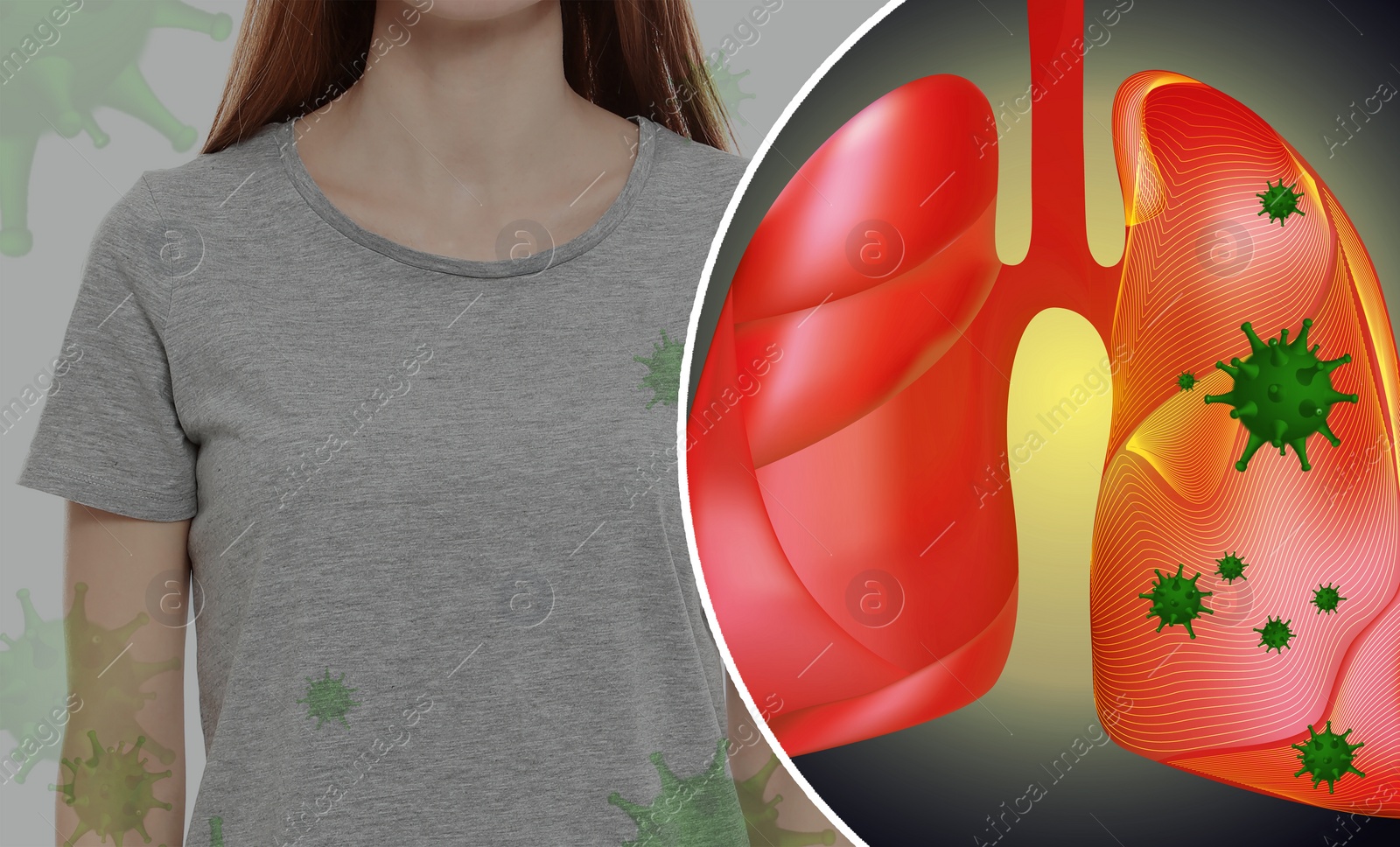 Image of Woman and illustration of her diseased lungs