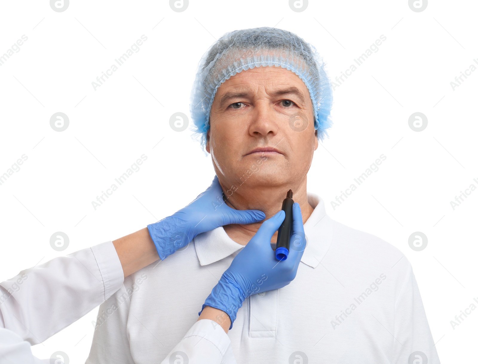 Photo of Surgeon with marker preparing man for operation against white background. Double chin removal