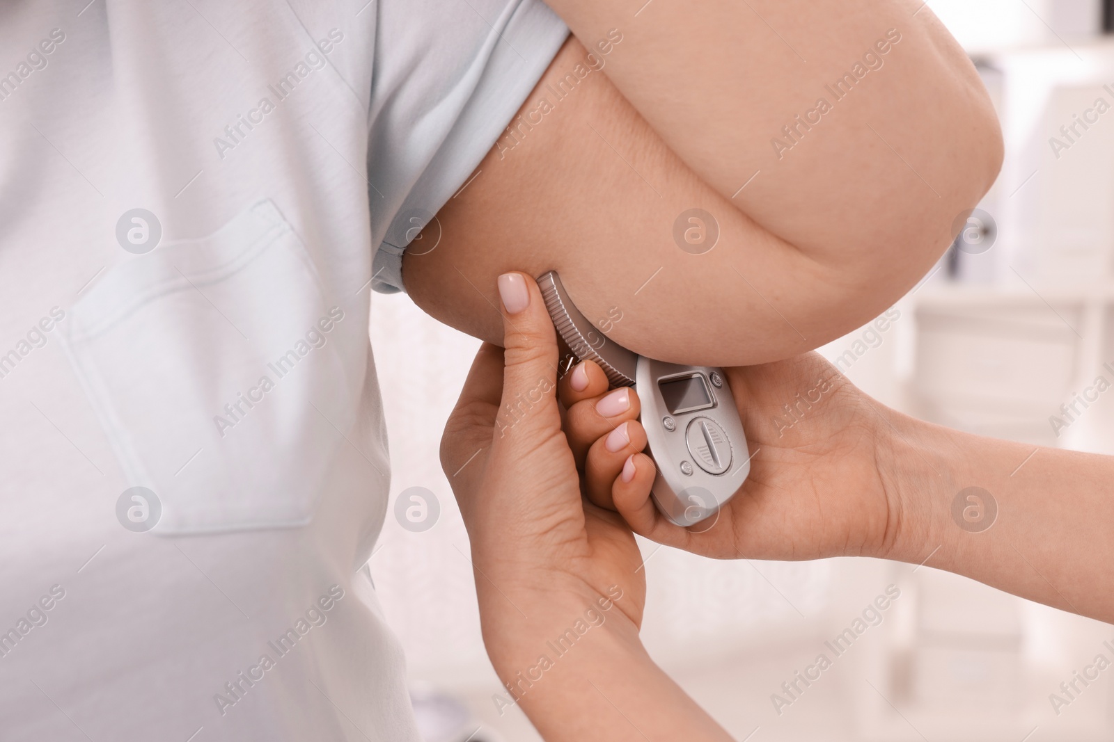 Photo of Nutritionist measuring overweight woman's body fat layer with caliper in clinic, closeup