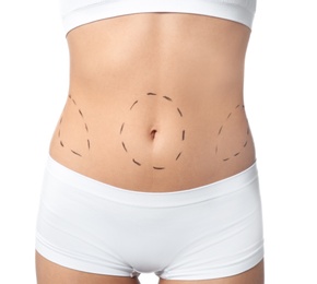Photo of Young woman with marks on body for cosmetic surgery operation against white background, closeup
