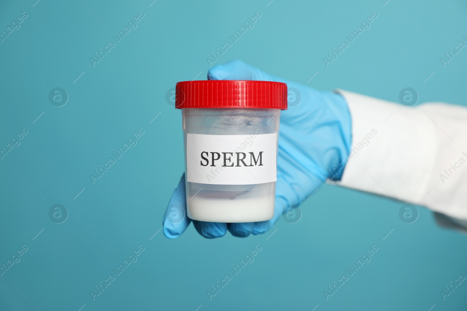 Photo of Scientist holding container with sperm on turquoise background, closeup