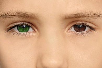 Little girl with different colors of eyes, closeup. Heterochromia iridis