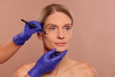 Doctor with pencil preparing patient for cosmetic surgery operation on light brown background