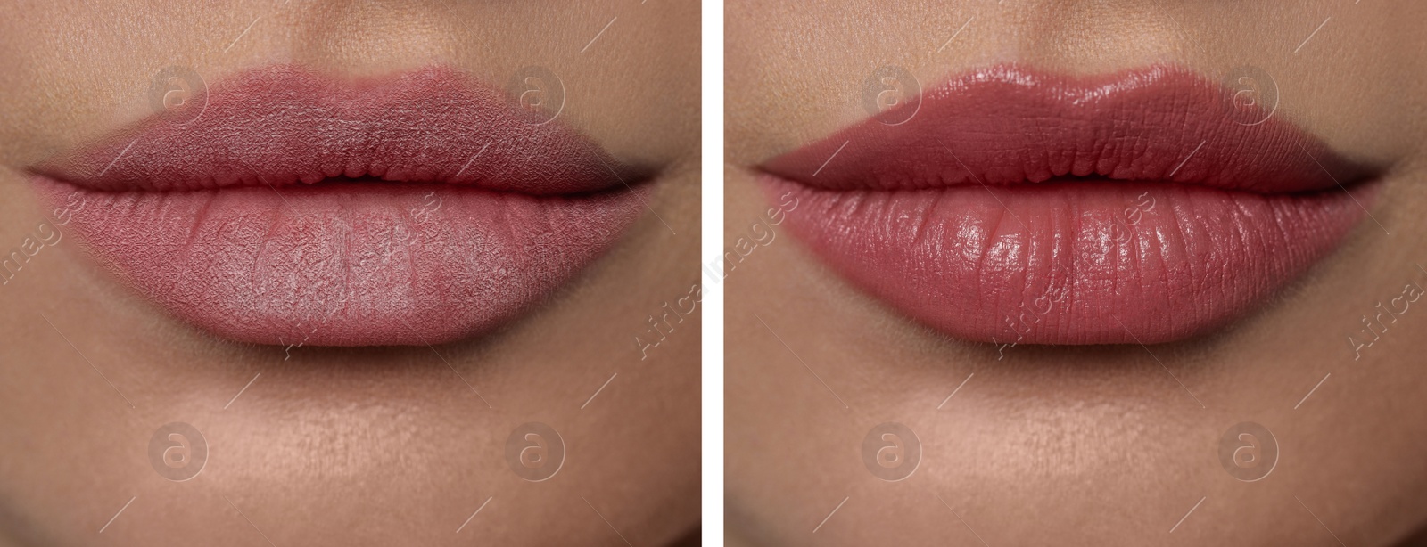 Image of Collage with photos of woman with dry and moisturized lips, closeup. Banner design