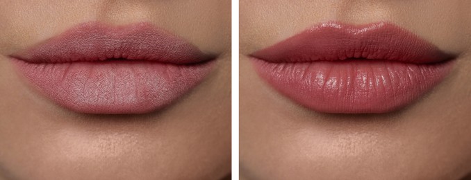 Image of Collage with photos of woman with dry and moisturized lips, closeup. Banner design