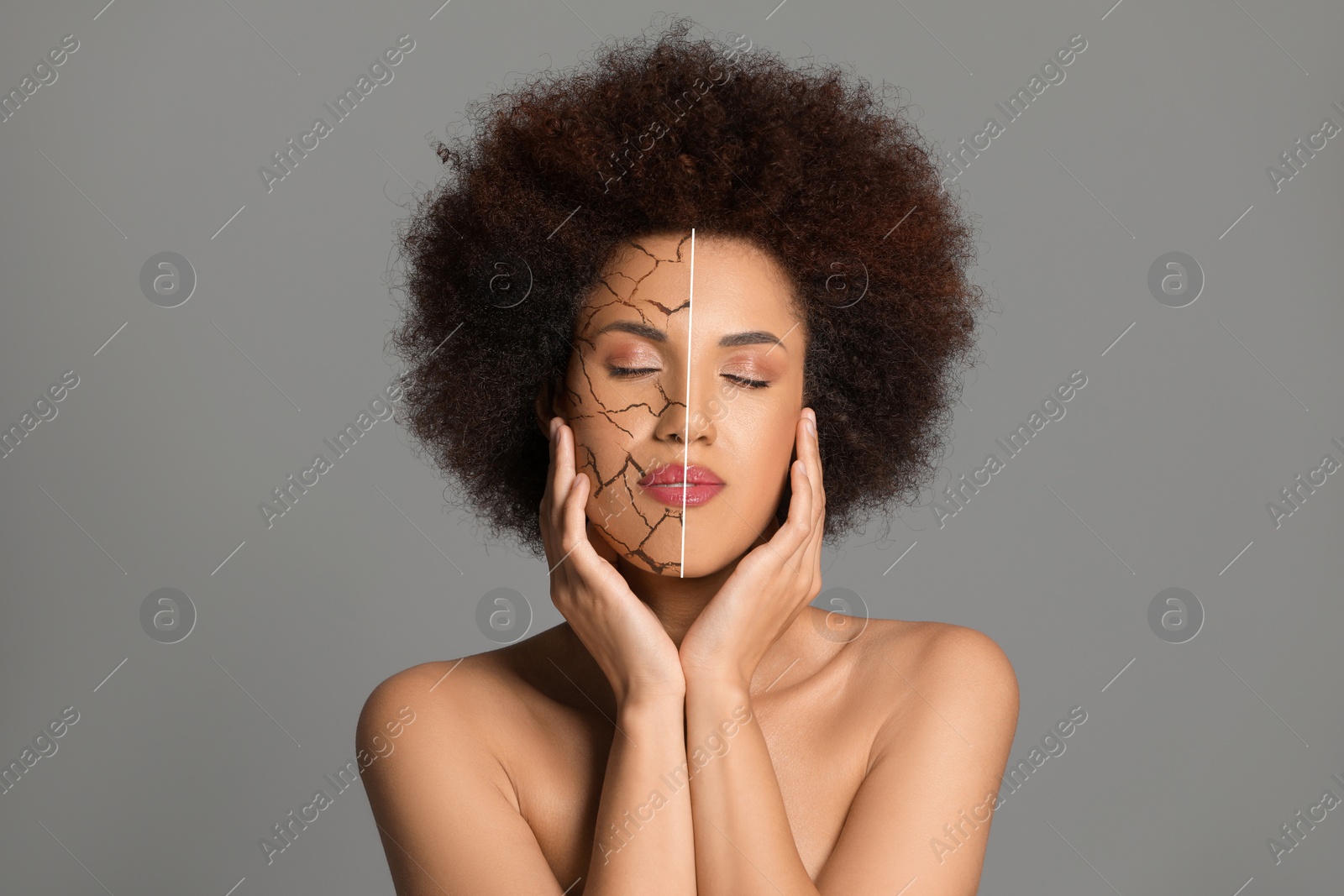 Image of Dry skin treatment. Beautiful woman before and after procedure on grey background, collage