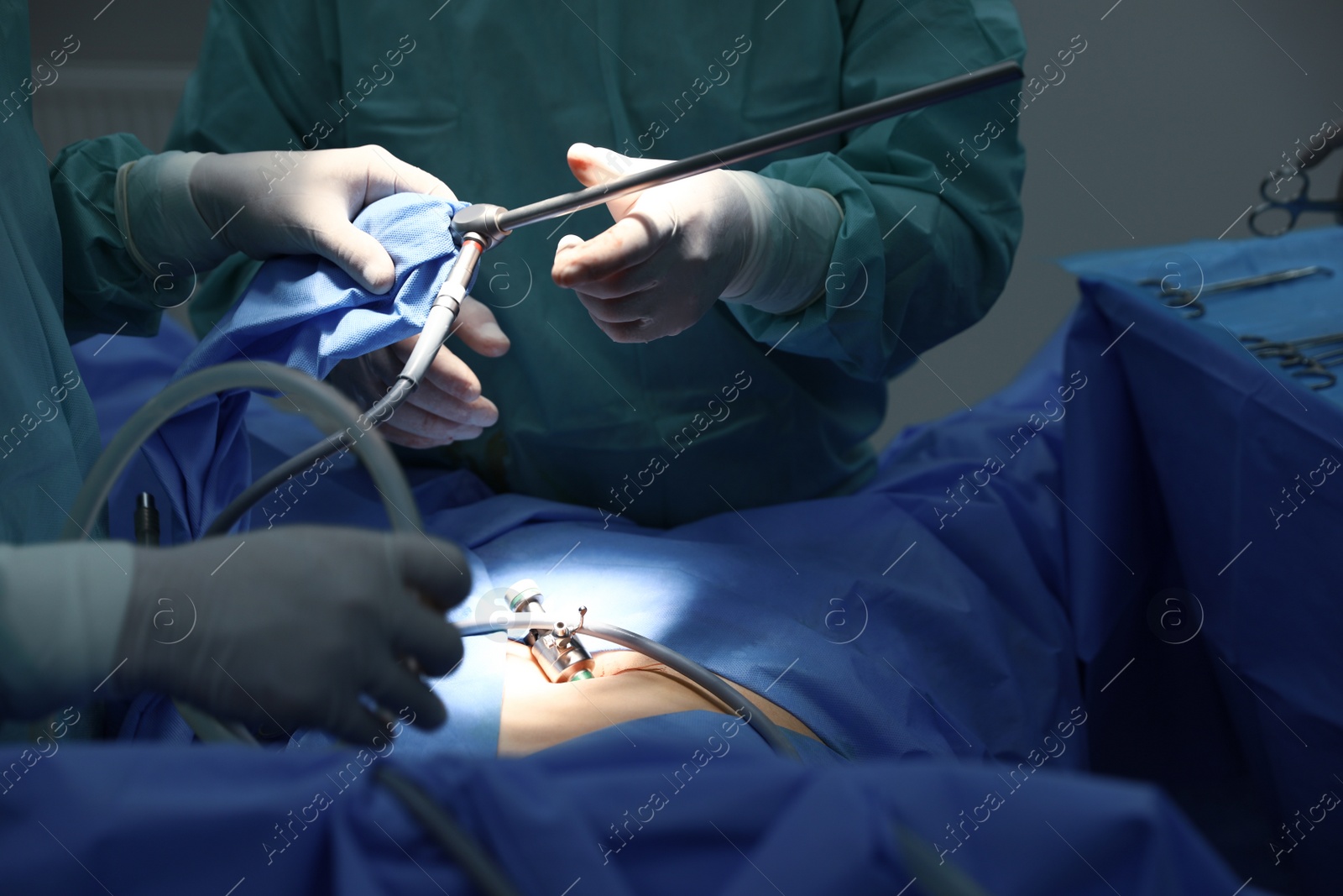 Photo of Medical team performing surgery in operating room, closeup