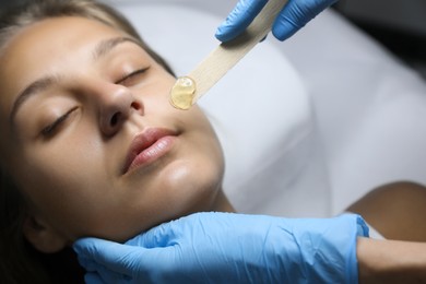 Young woman undergoing hair removal procedure on face with sugaring paste in salon, closeup