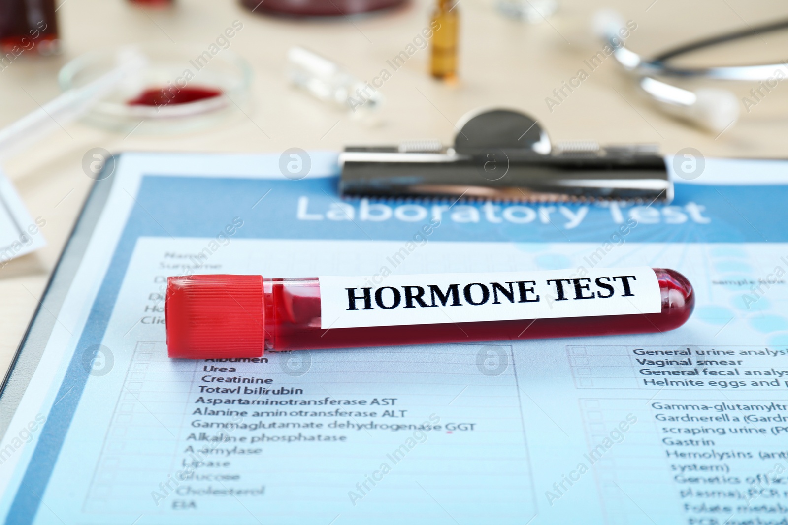 Photo of Hormone test. Sample tube with blood and laboratory form on table, closeup