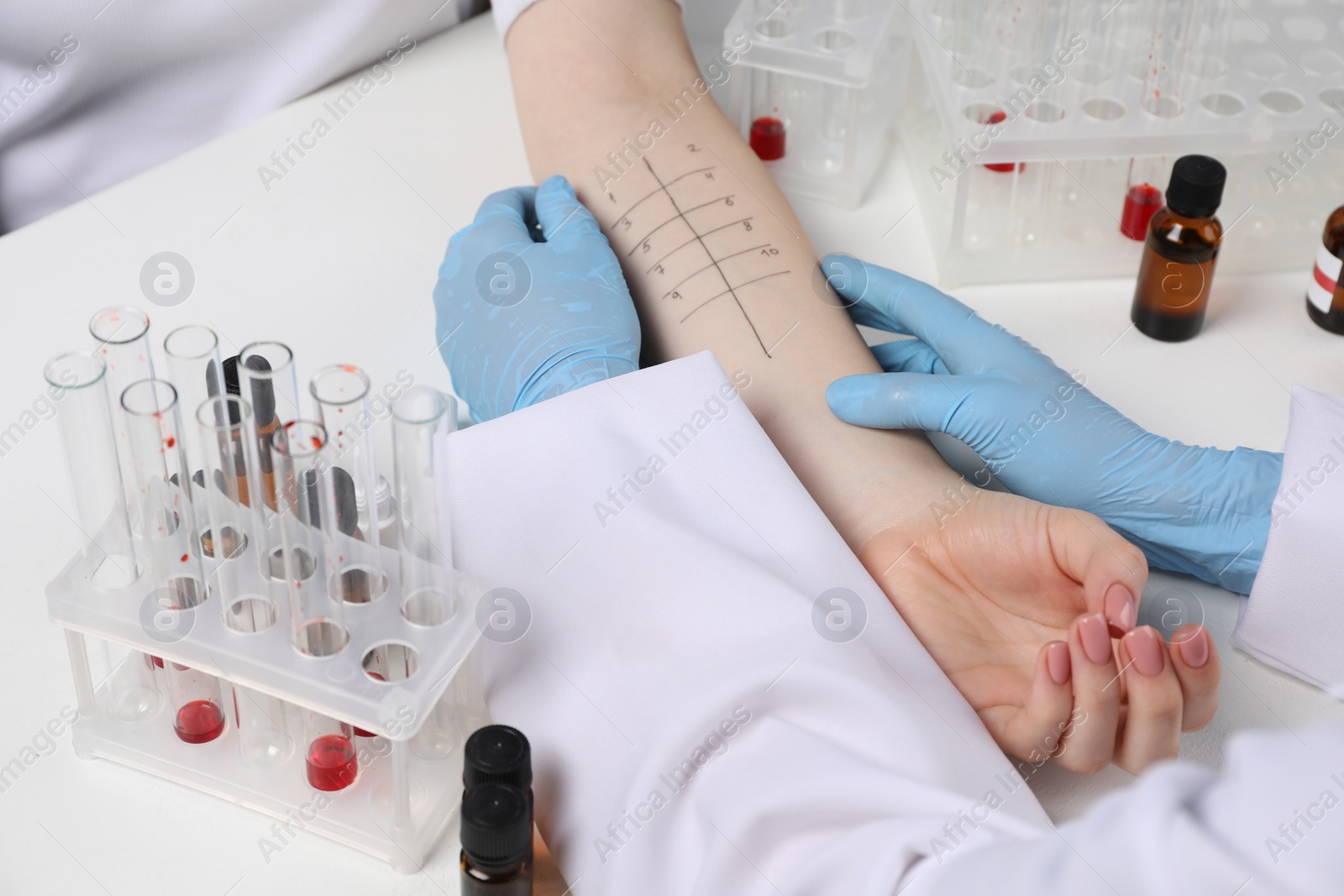 Photo of Doctor doing skin allergy test at light table, closeup