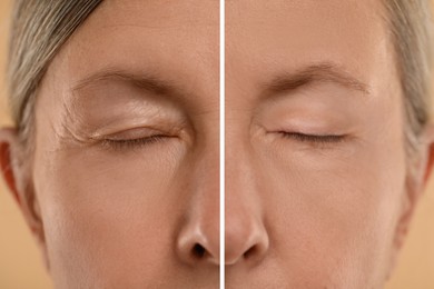 Aging skin changes. Woman showing face before and after rejuvenation, closeup. Collage comparing skin condition