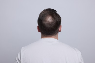 Photo of Baldness concept. Man with bald spot on light grey background, back view