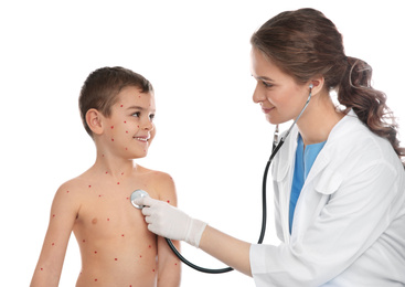 Photo of Doctor examining little boy with chickenpox on white background. Varicella zoster virus
