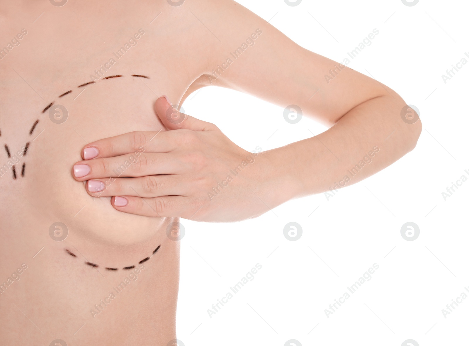 Photo of Young woman with marks on breast for cosmetic surgery operation against white background