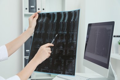 Doctor examining neck MRI image in clinic, closeup