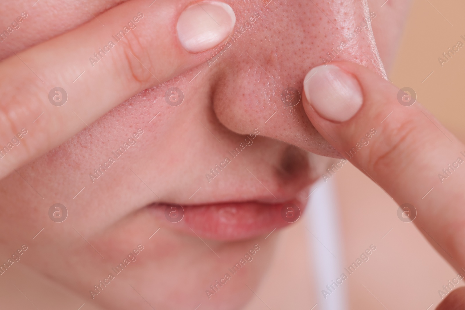 Photo of Woman popping pimple on her nose, closeup