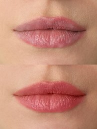 Collage with photos of young woman before and after permanent lip makeup, closeup