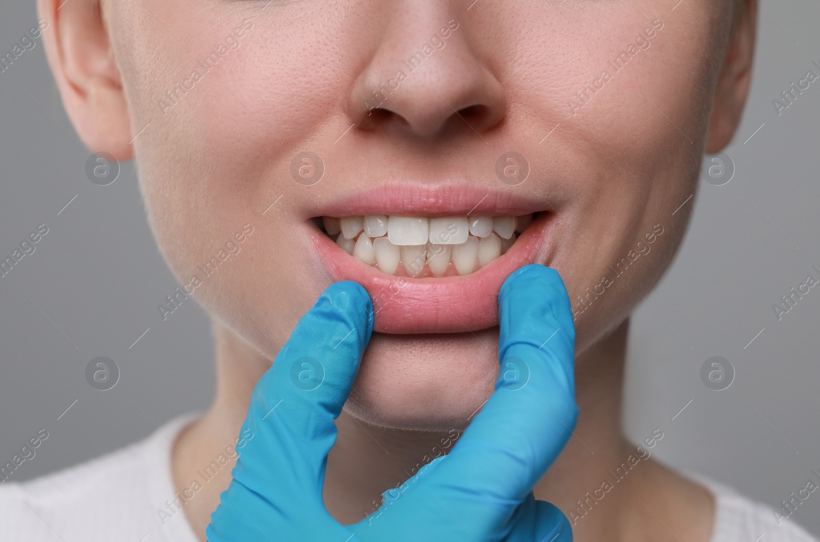 Photo of Doctor examining woman's gums on grey background, closeup