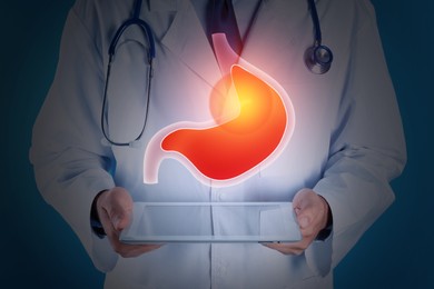 Treatment of heartburn and other gastrointestinal diseases. Doctor using tablet on dark background, closeup. Stomach illustration over device