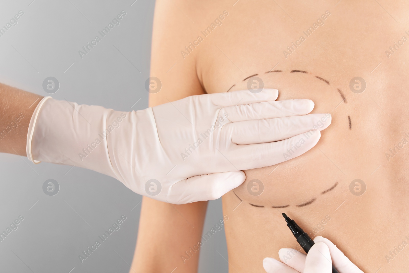 Photo of Doctor drawing marks on patient's breast for cosmetic surgery operation against gray background, closeup