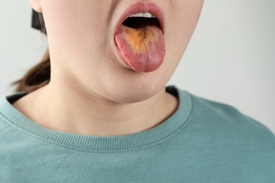 Gastrointestinal diseases. Woman showing her yellow tongue on light grey background, closeup