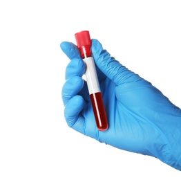 Photo of Laboratory worker holding test tube with blood sample for analysis isolated on white, closeup