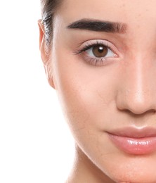 Image of Young woman with dry skin on white background, closeup