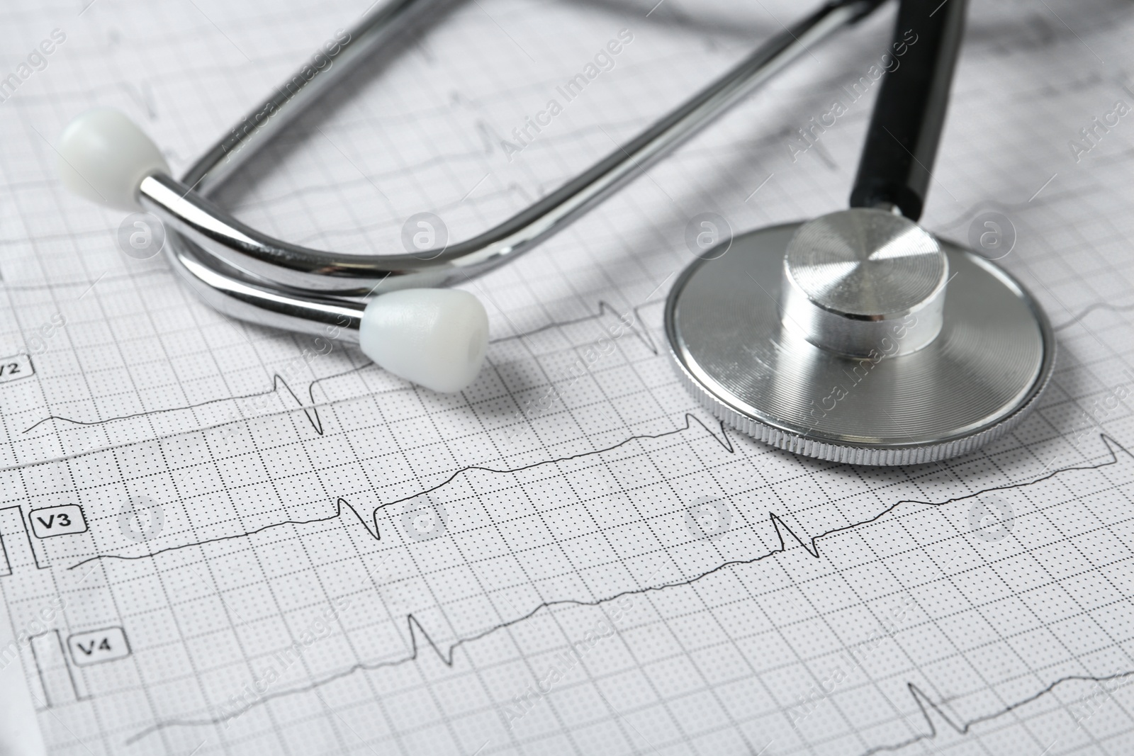 Photo of Stethoscope on cardiogram report, closeup view. Heart diagnosis