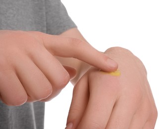 Photo of Man applying yellow ointment onto his hand on white background, closeup