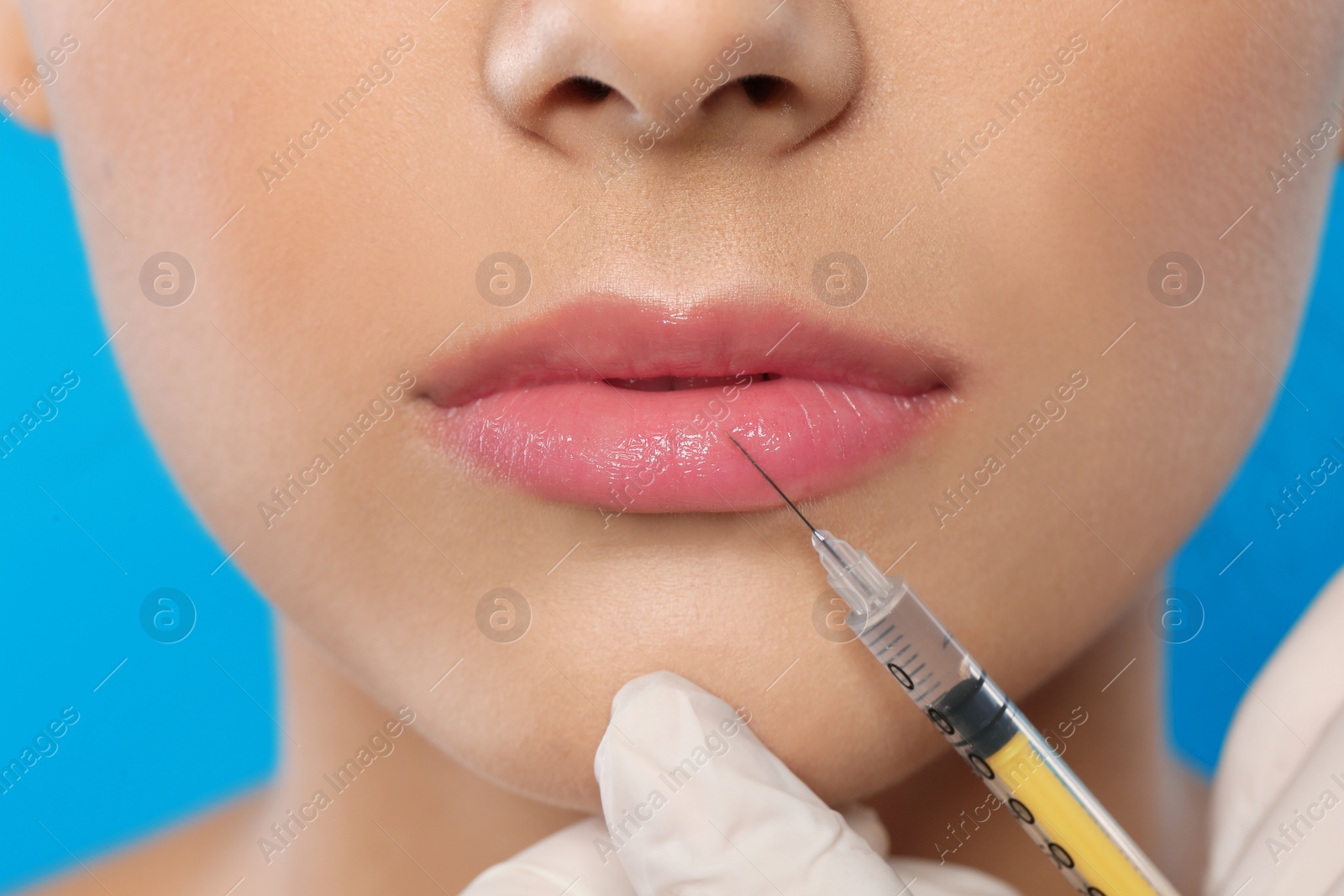 Photo of Young woman getting lips injection, closeup. Cosmetic surgery