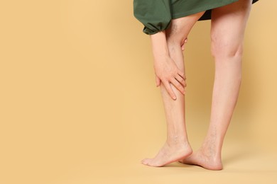 Photo of Closeup view of woman suffering from varicose veins on yellow background. Space for text