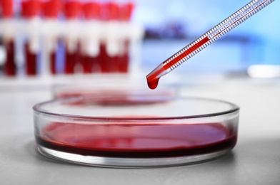 Photo of Pipetting blood into Petri dish for analysis on table in laboratory, closeup