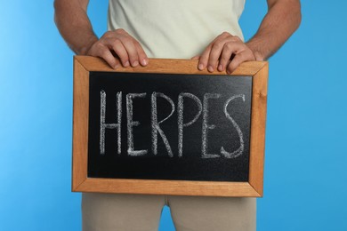 Photo of Man holding small chalkboard with word Herpes on light blue background