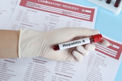 Photo of Scientist holding tube with blood sample and label Hepatitis A near laboratory test form, closeup