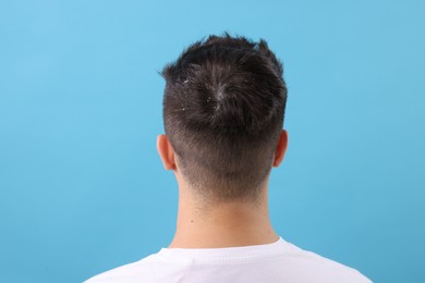 Man with dandruff in his dark hair on light blue background, back view