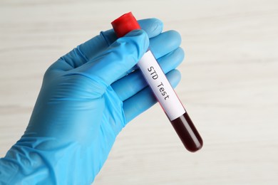 Photo of Scientist holding tube with blood sample and label STD Test on white background, closeup