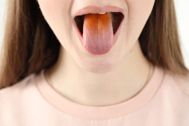 Gastrointestinal diseases. Woman showing her yellow tongue, closeup