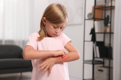 Photo of Suffering from allergy. Little girl scratching her arm at home